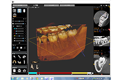 歯科用CT装置