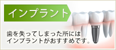 インプラント